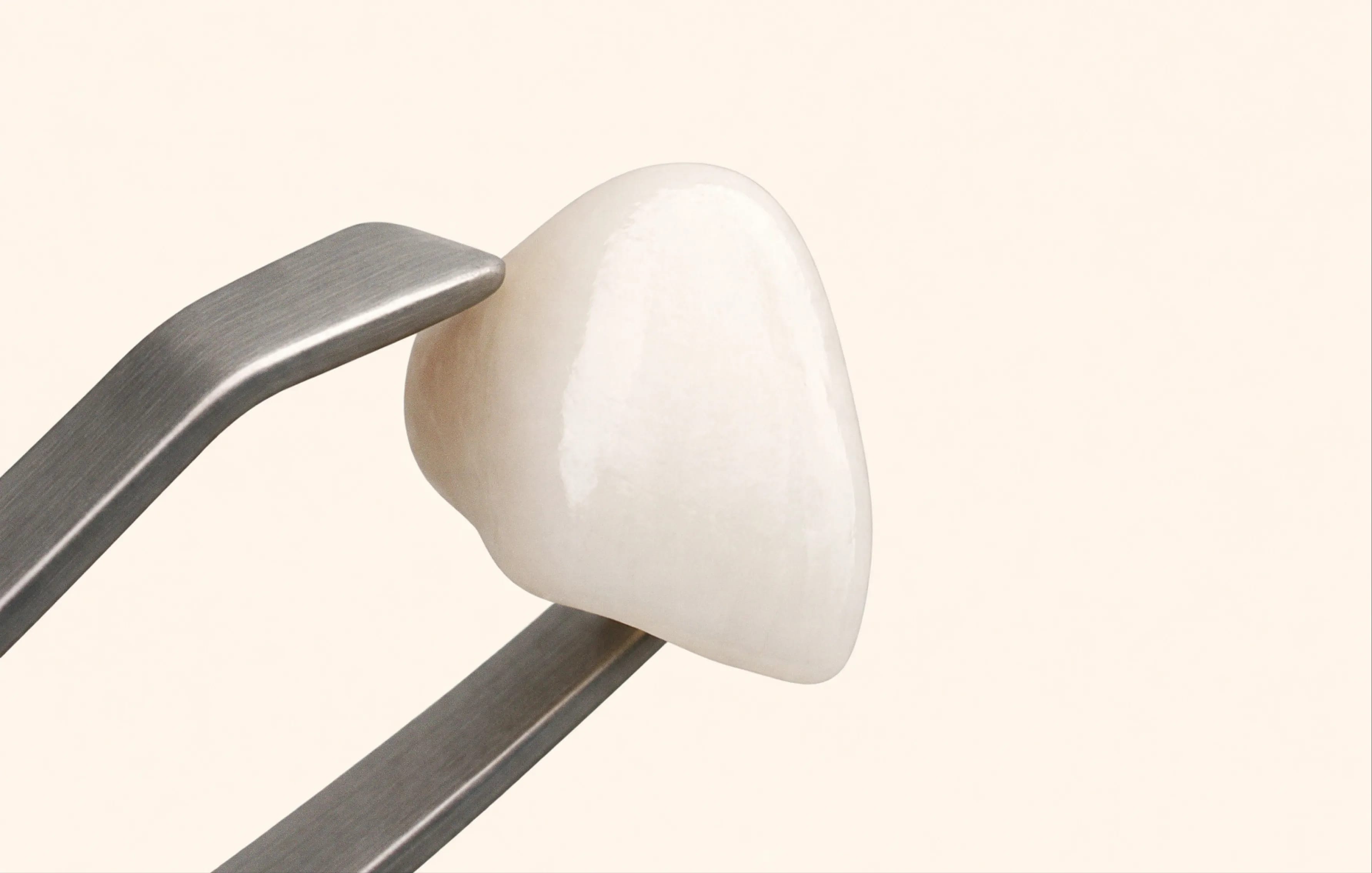 IU dental crowns