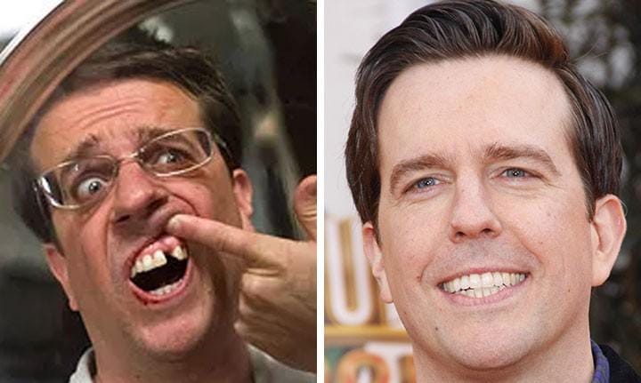 IU Ed Helms before and after