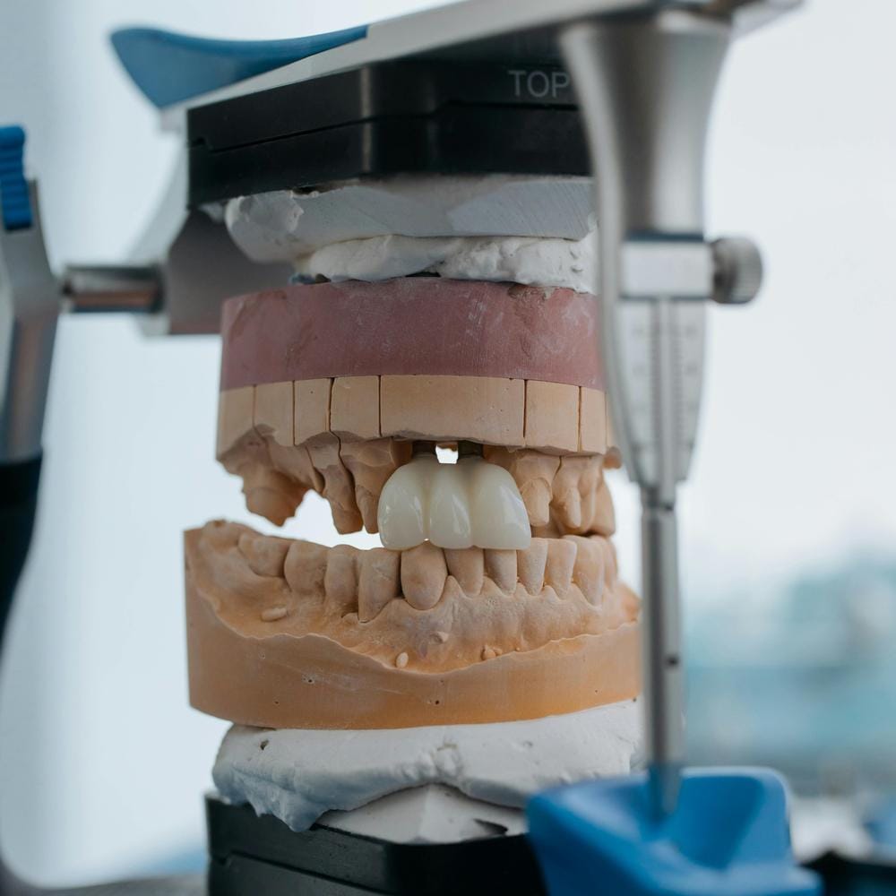 IU fixed bridge treatment options