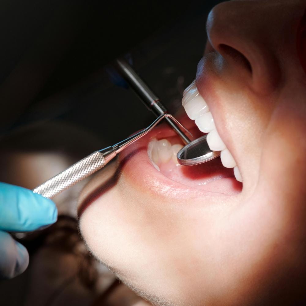 IU dental implants for front teeth