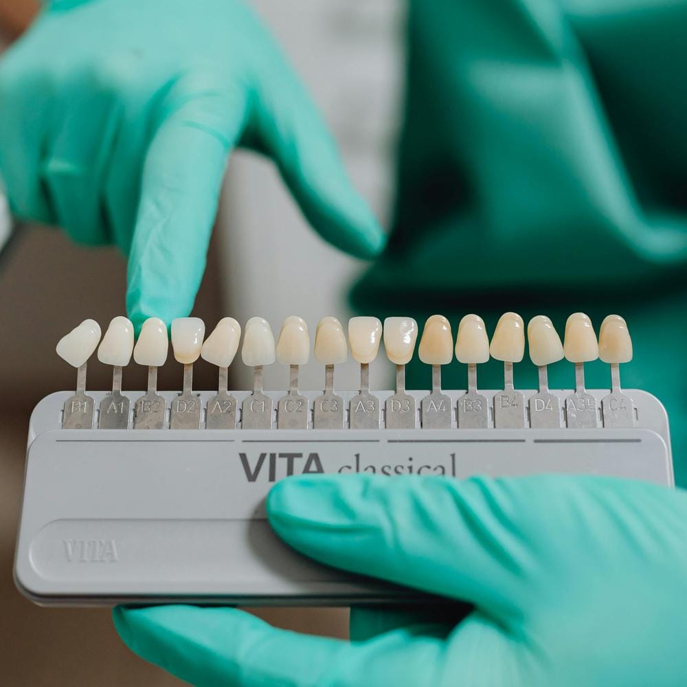 internal-tooth-whitening