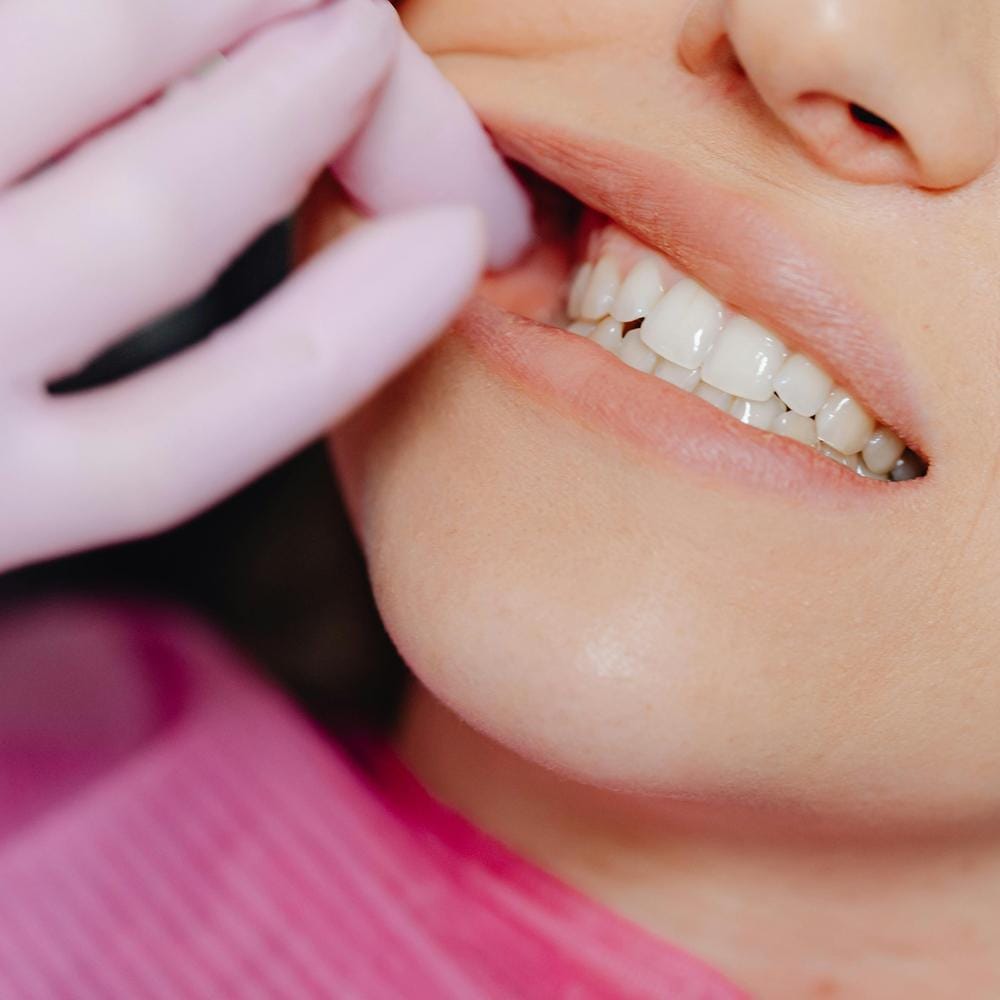 peri-implantitis