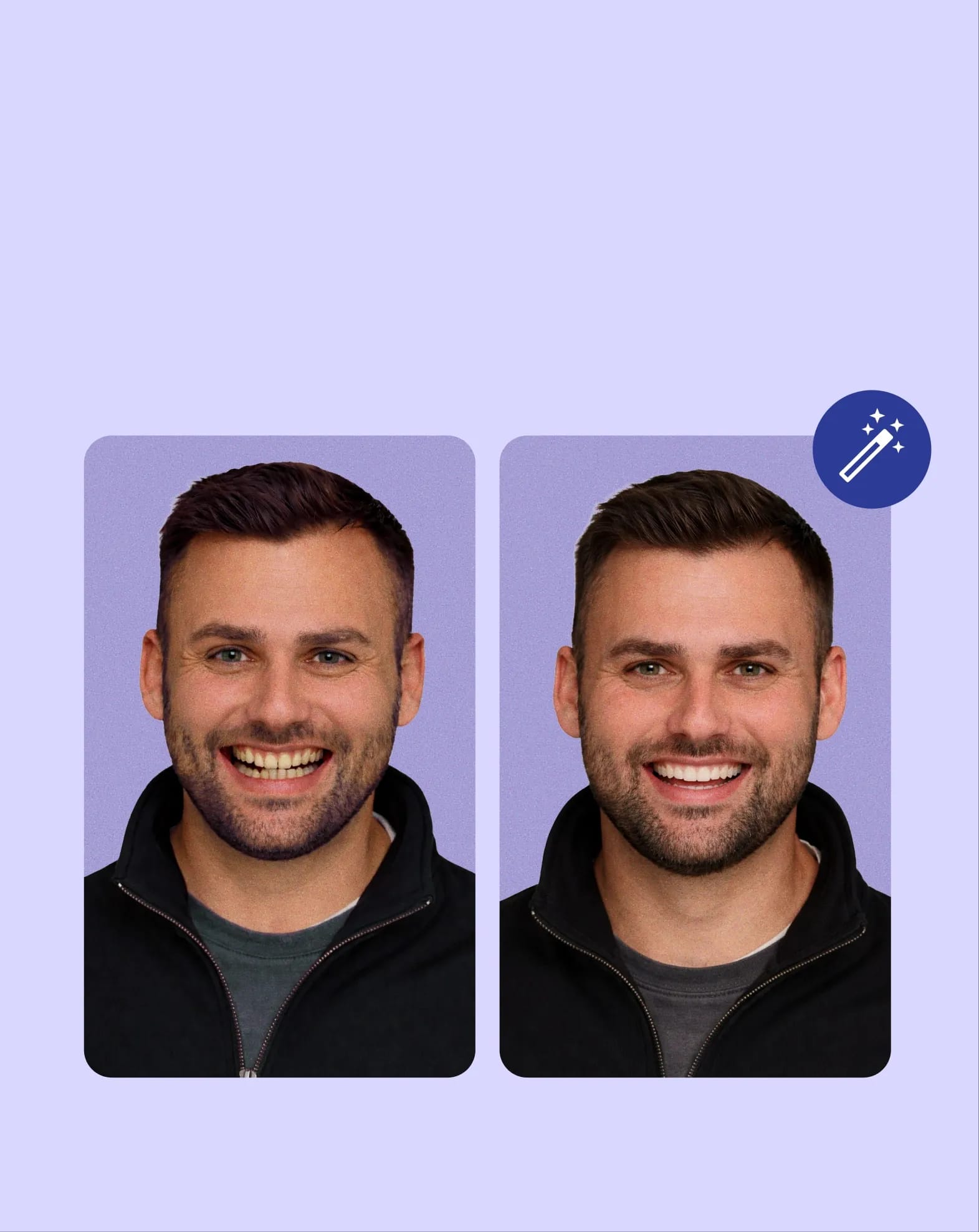 Smile transformation