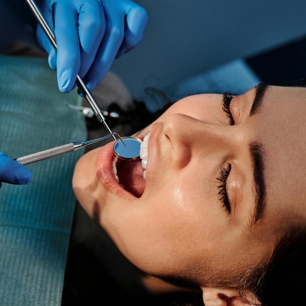 what-are-dental-inlays