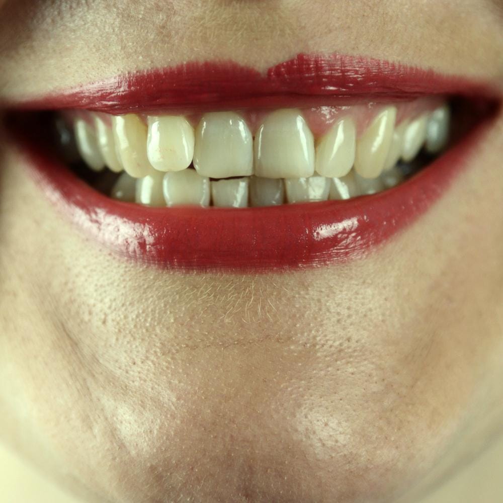 why-are-my-teeth-yellow