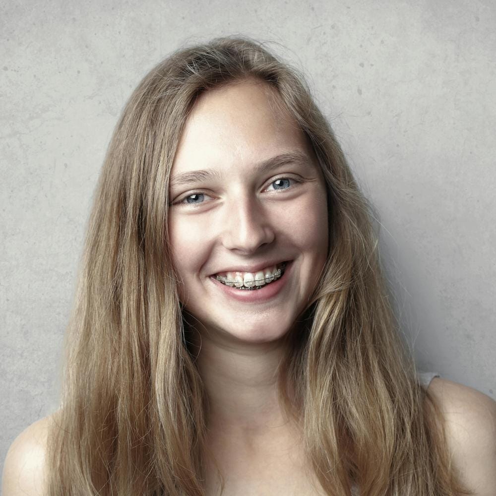 yellow-teeth-and-braces