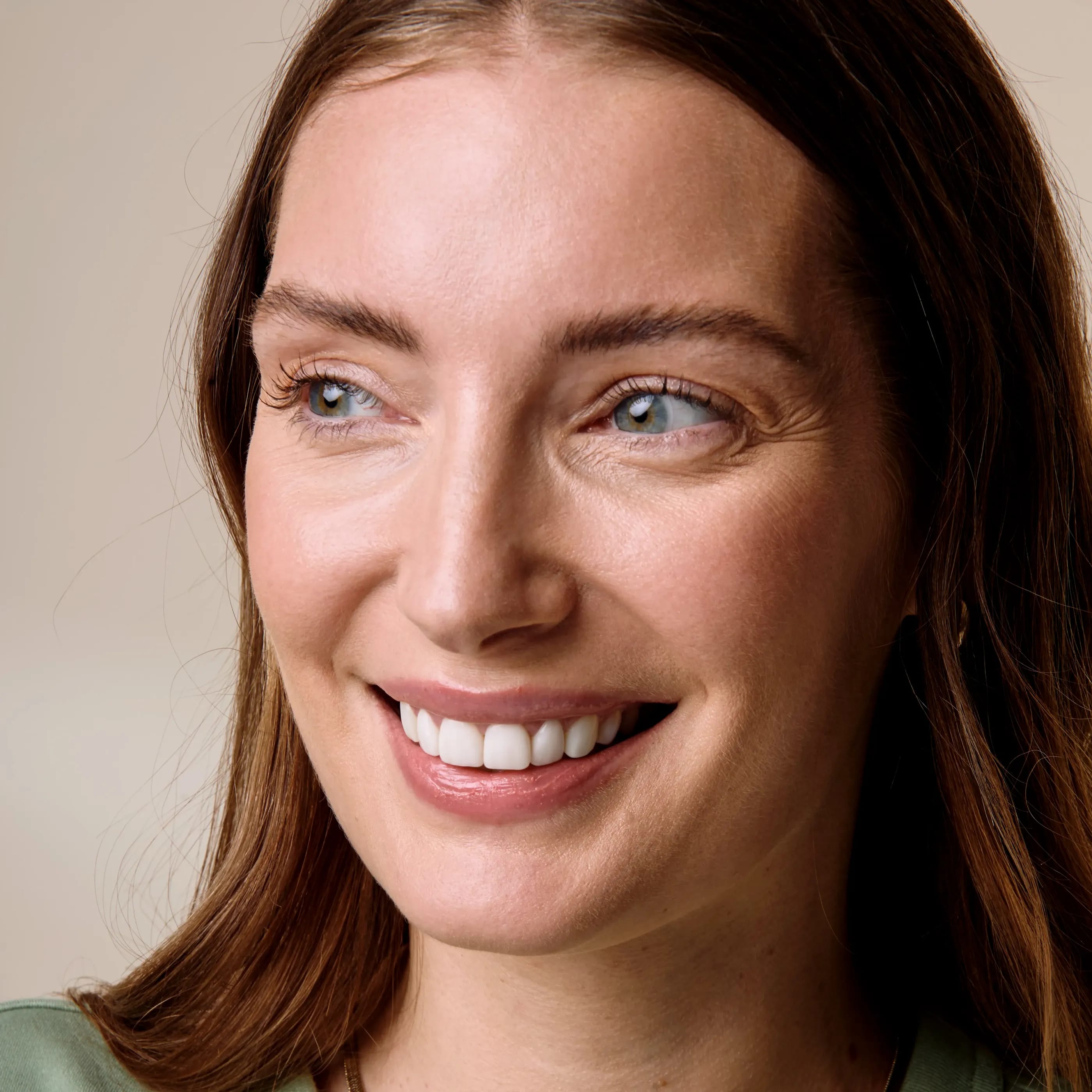 IU composite bonding for Katie (face 3) 1x1