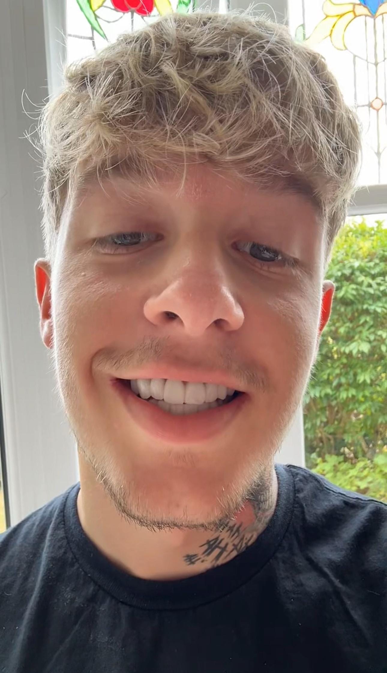 reagan-turkey-teeth-transformation