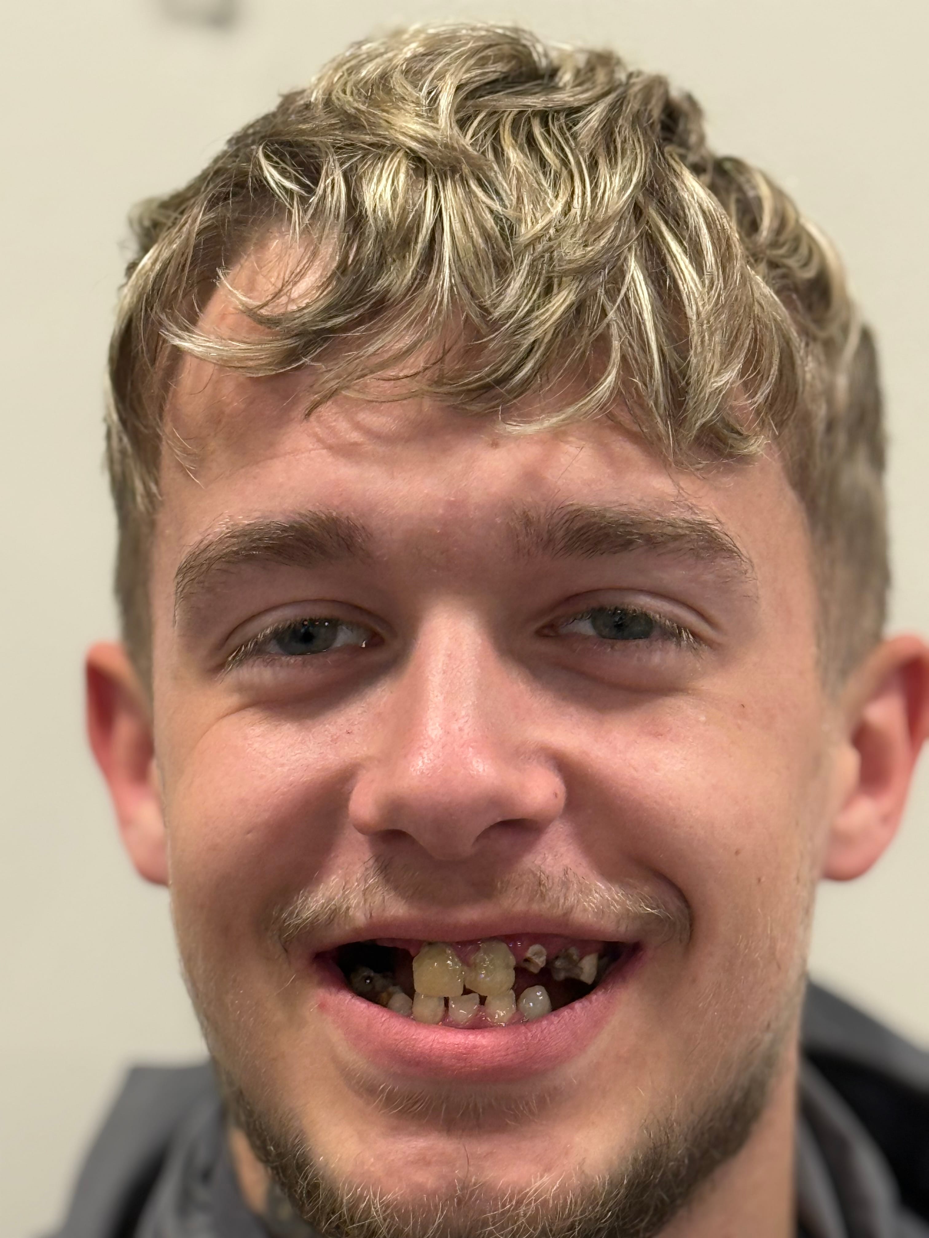 reagan-turkey-teeth-transformation