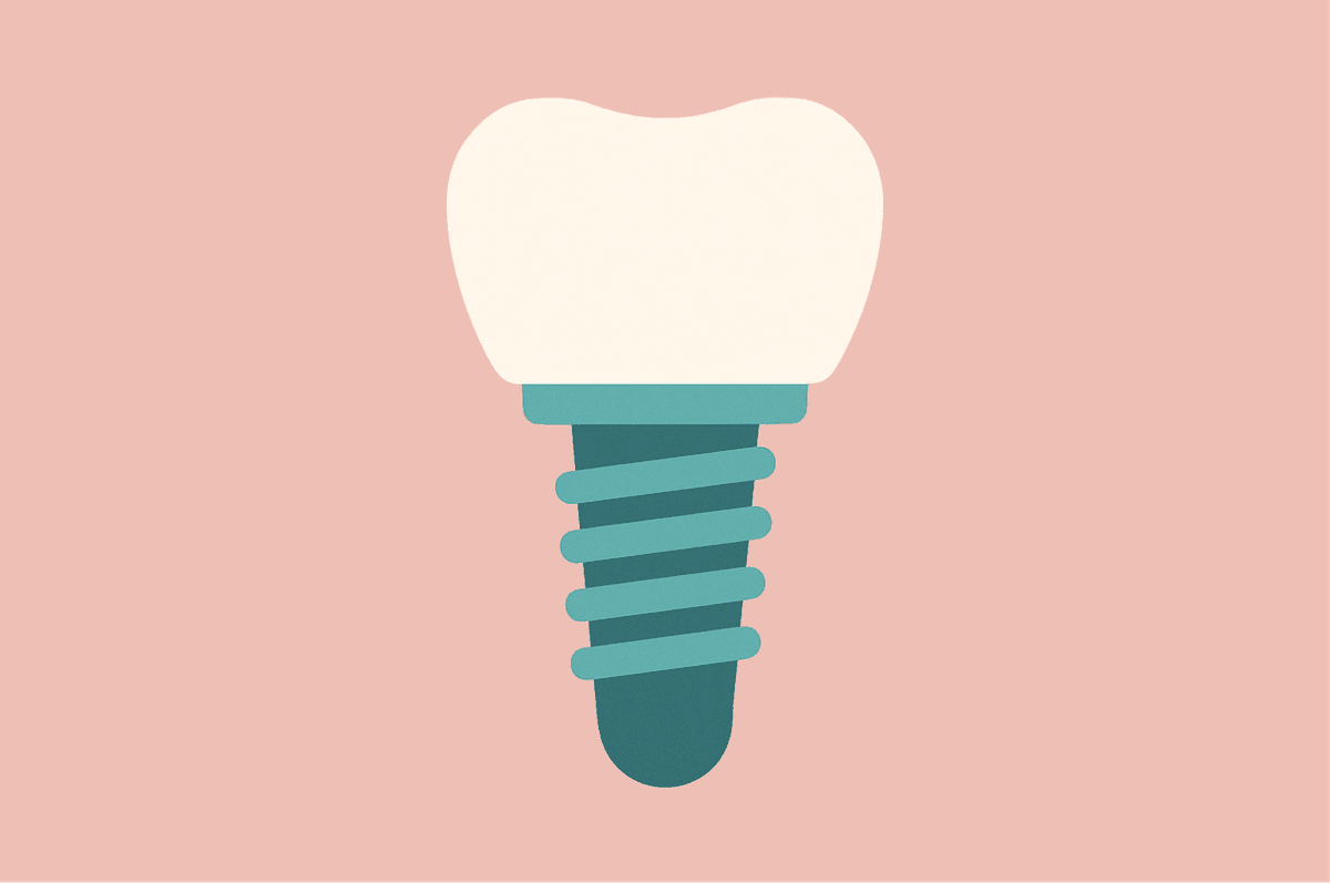 IU single dental implant