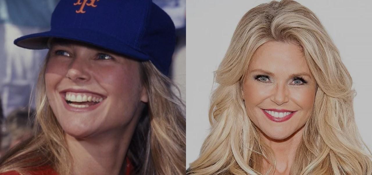 IU Christie Brinkley before and after photo
