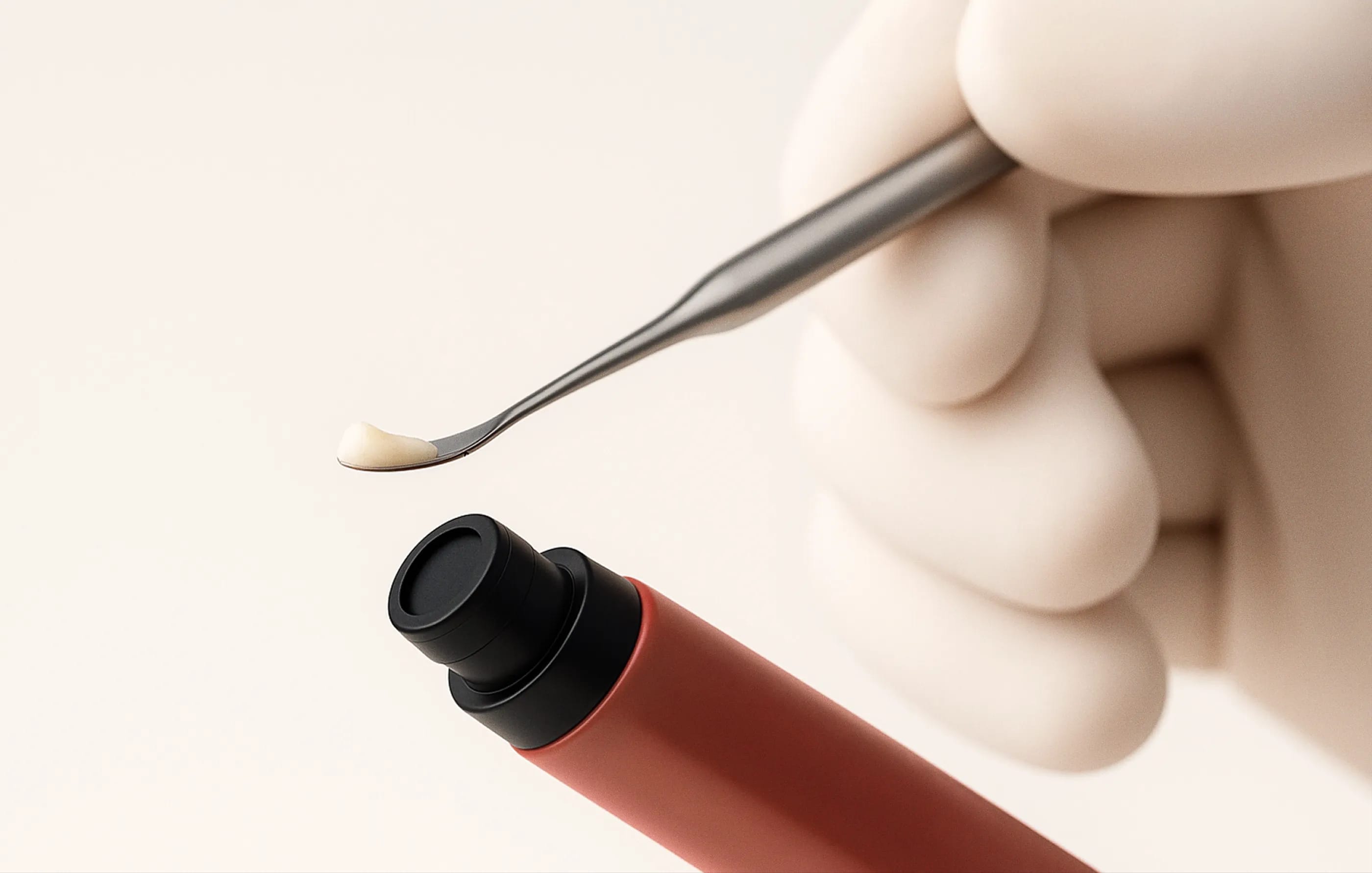 IU composite filling
