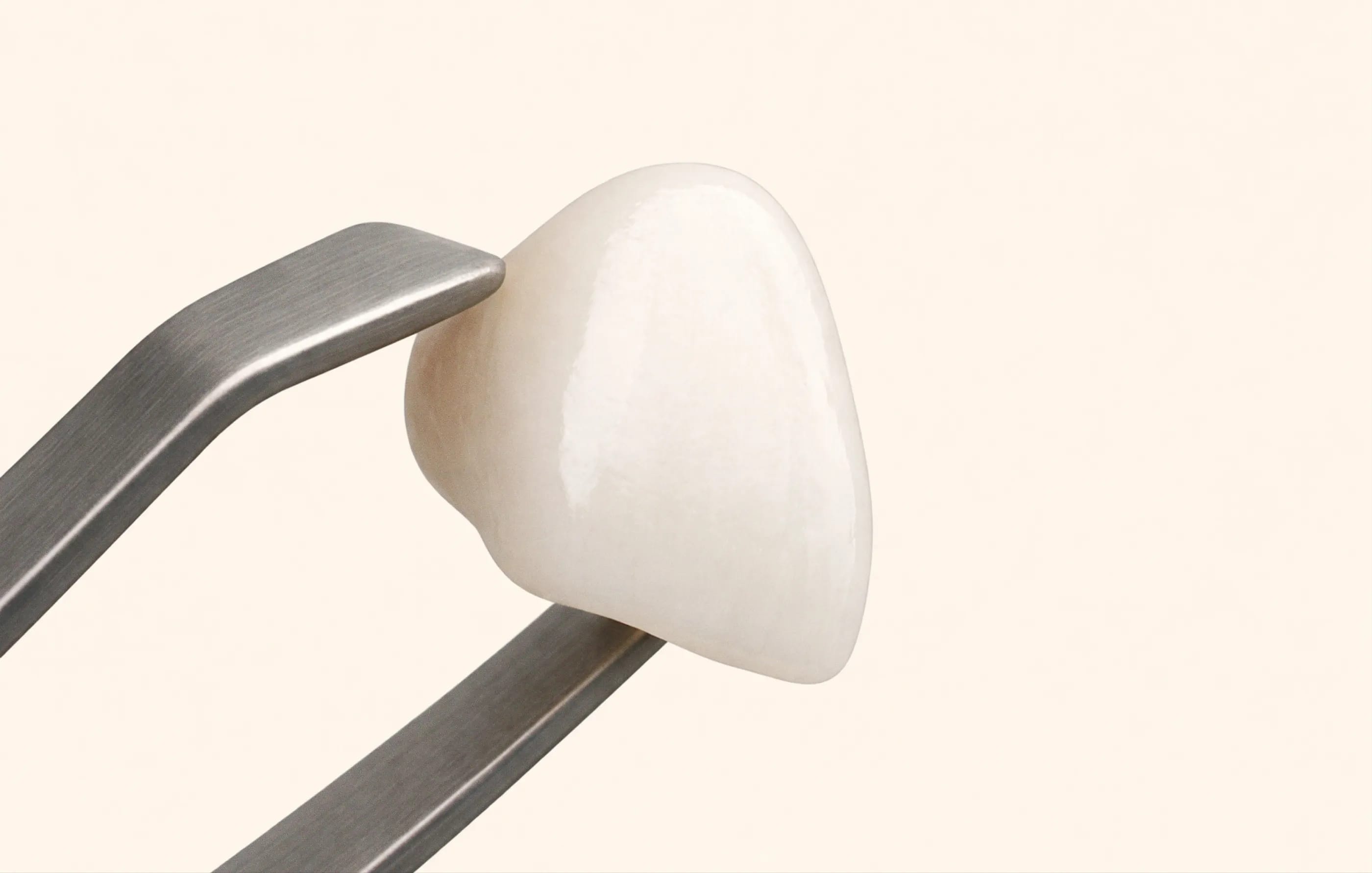 IU dental crown for teeth