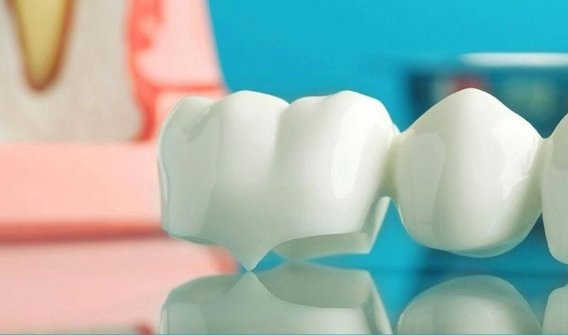 IU dental implant side effects