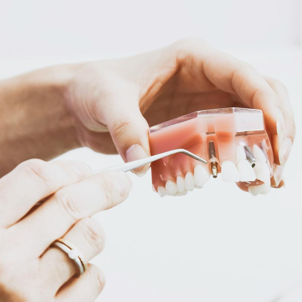 IU can i get dental implants with receding gums