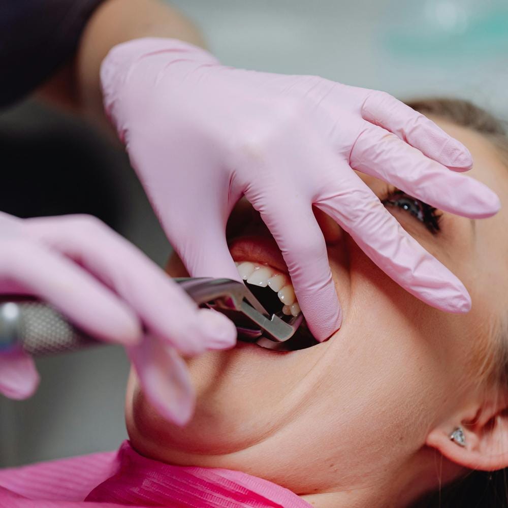 immediate-tooth-implant-after-extraction