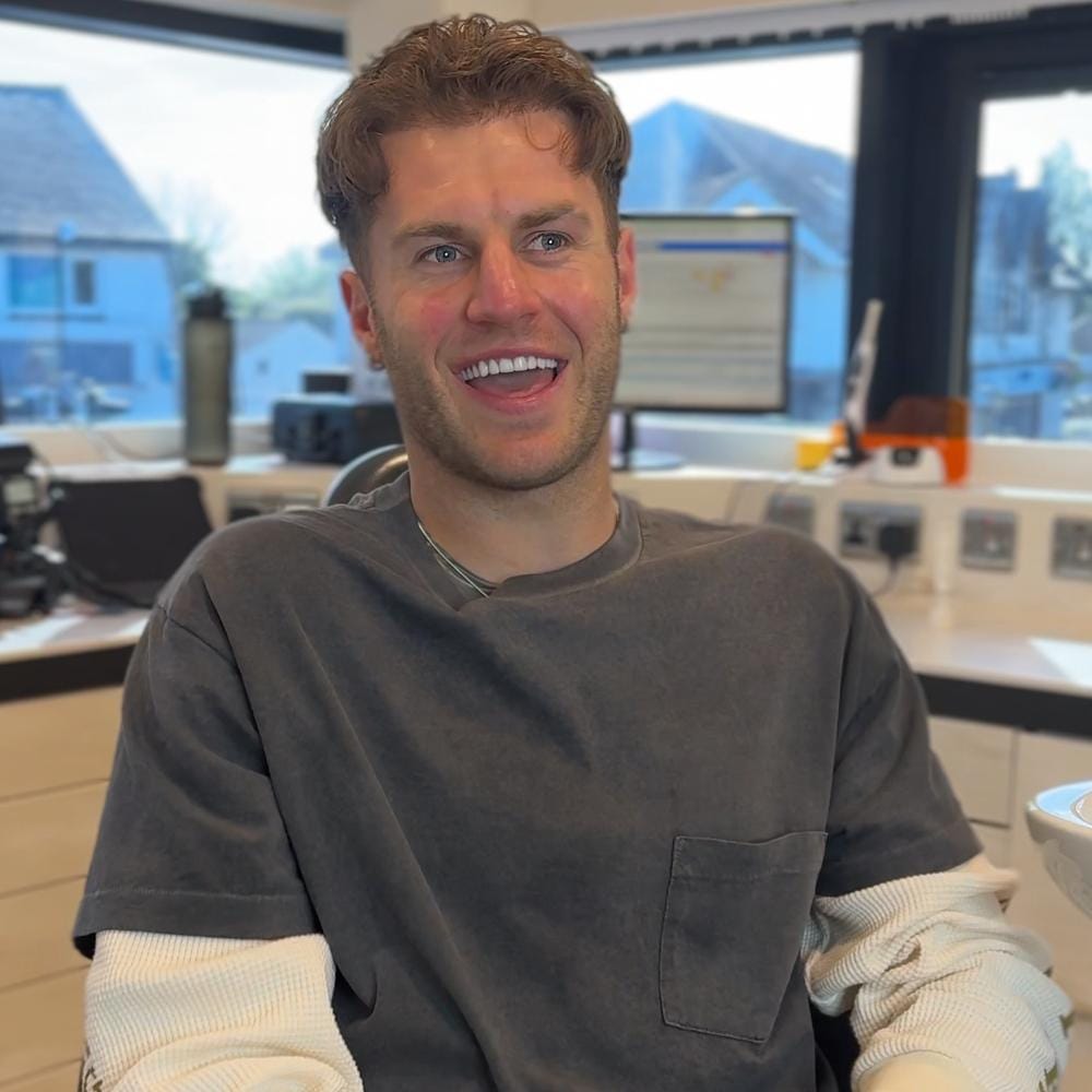 joe-rodon-veneers