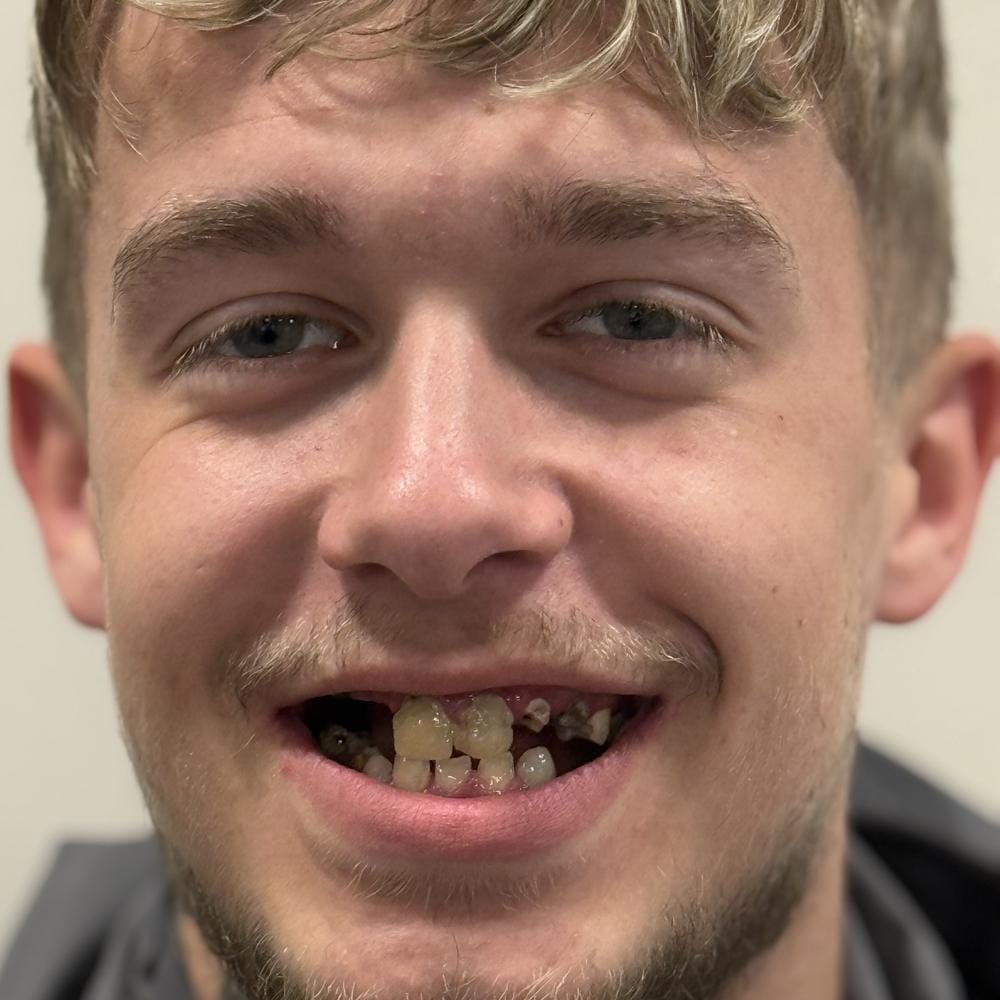 reagan-turkey-teeth-transformation-2
