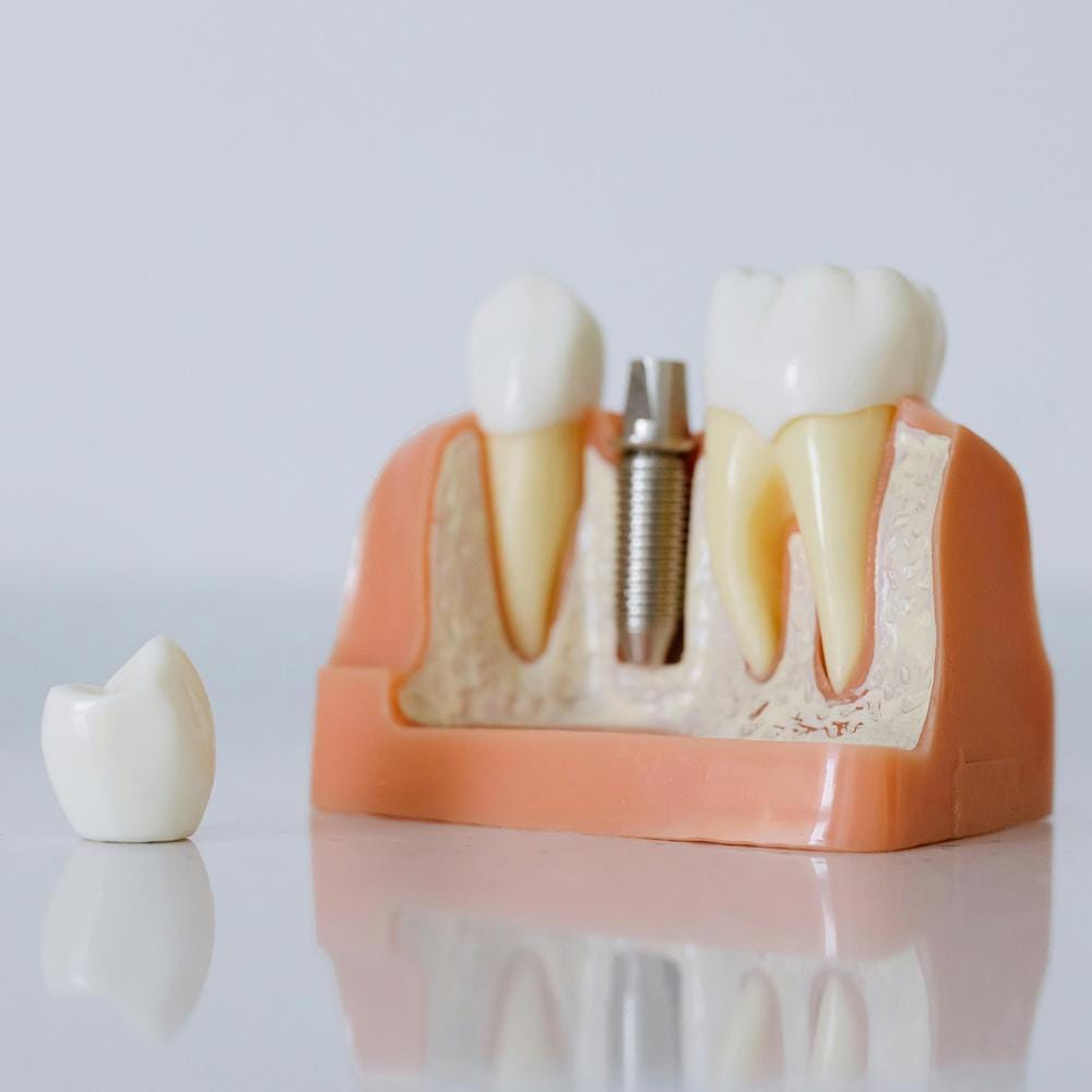 single-false-tooth