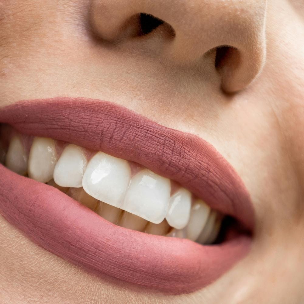 teeth-whitening-strips-do-they-work-are-they-safe