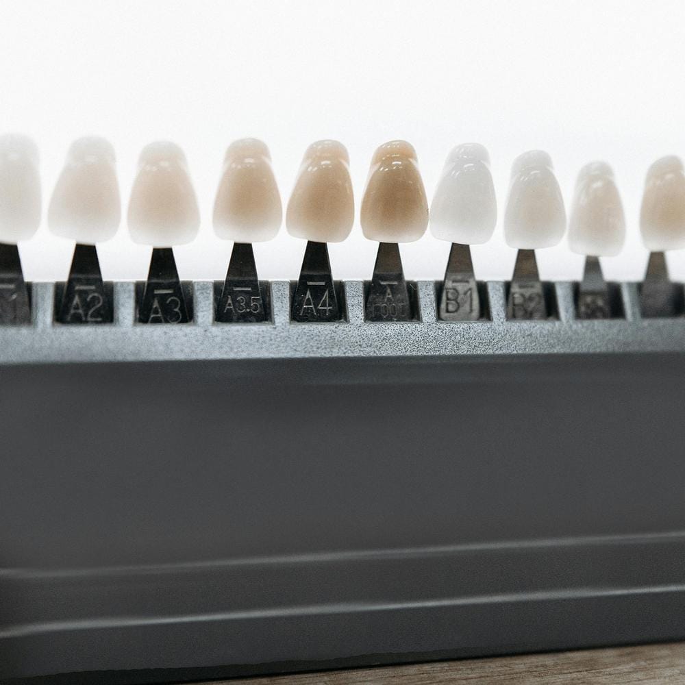 tooth-discolouration