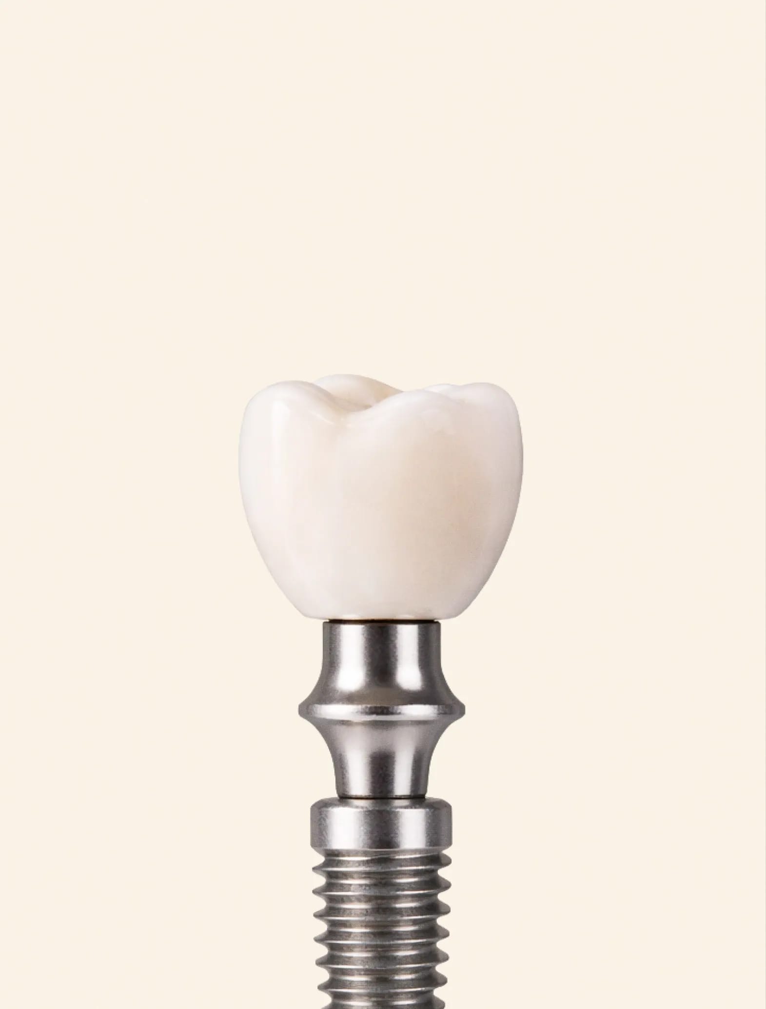 Dental implant crown