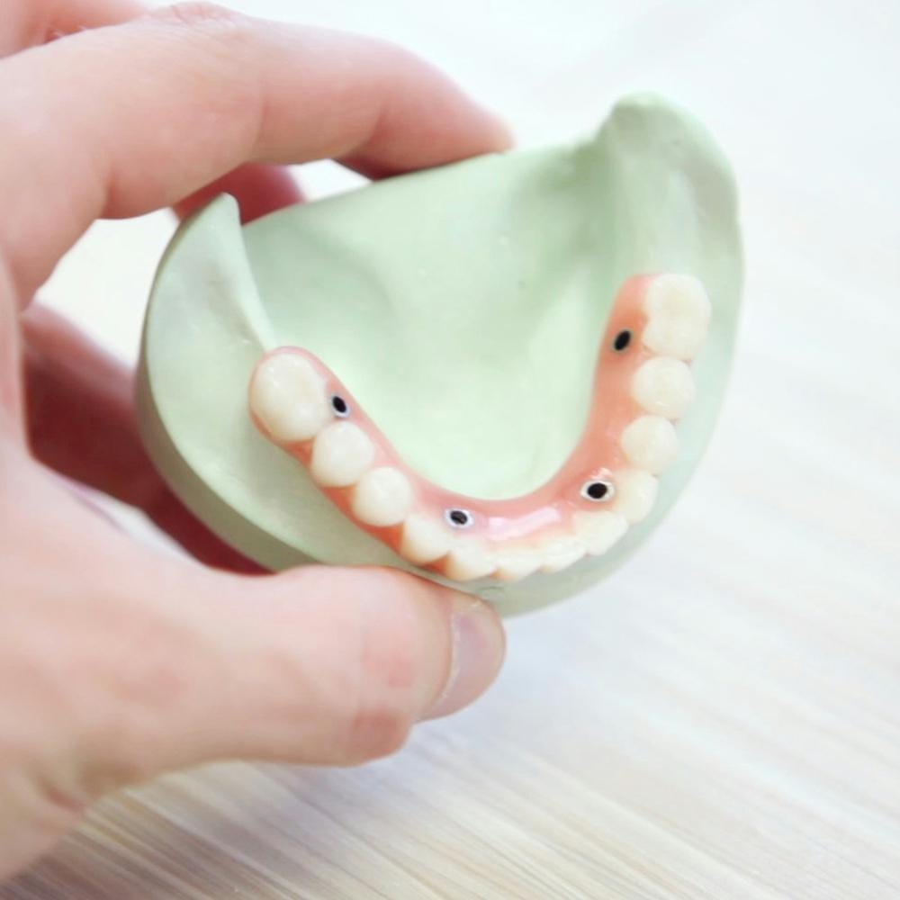 What are dental implants